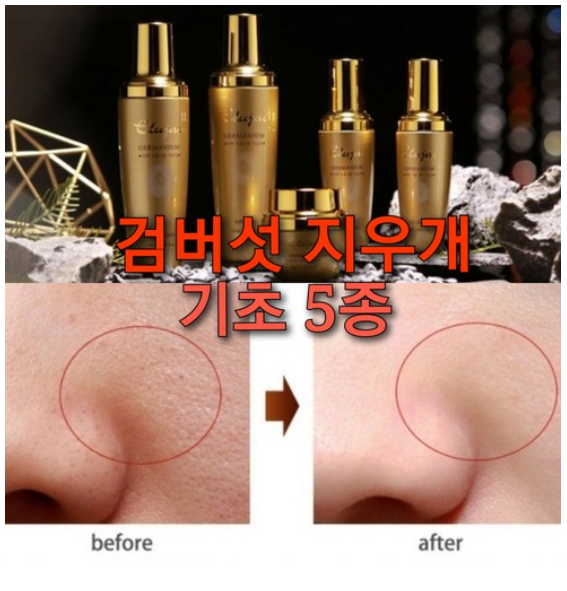 검버섯지우게 5종 세트/고흡수 아데노신 기능성스킨케어, 잔주름 검버섯지우게..., 1개